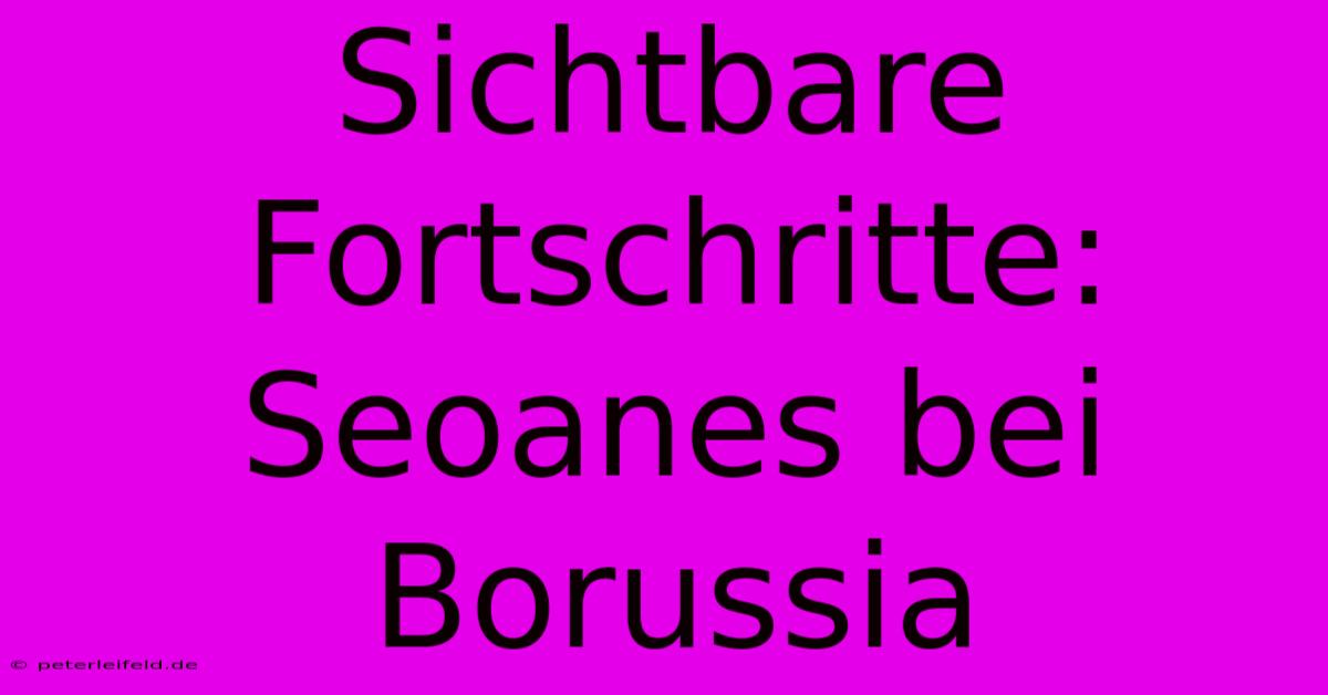 Sichtbare Fortschritte: Seoanes Bei Borussia